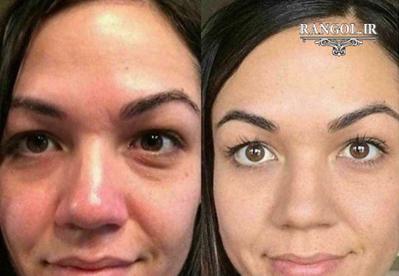 مراقبت از پوست مشکلات پوستی محصولات مراقبت از پوست درمان آکنه پوست سالم و درخشان نکات زیبایی پوست کرم‌های ضد پیری پوست جوانسازی پوست